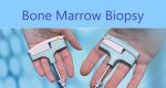 Bone Marrow biopsy
